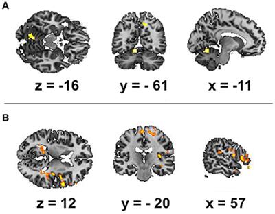 Correlation of BOLD Signal with Linear and Nonlinear Patterns of EEG in Resting State EEG-Informed fMRI